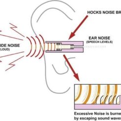 Alternative view of ที่อุดหู SureFire EP3 size M สีใส